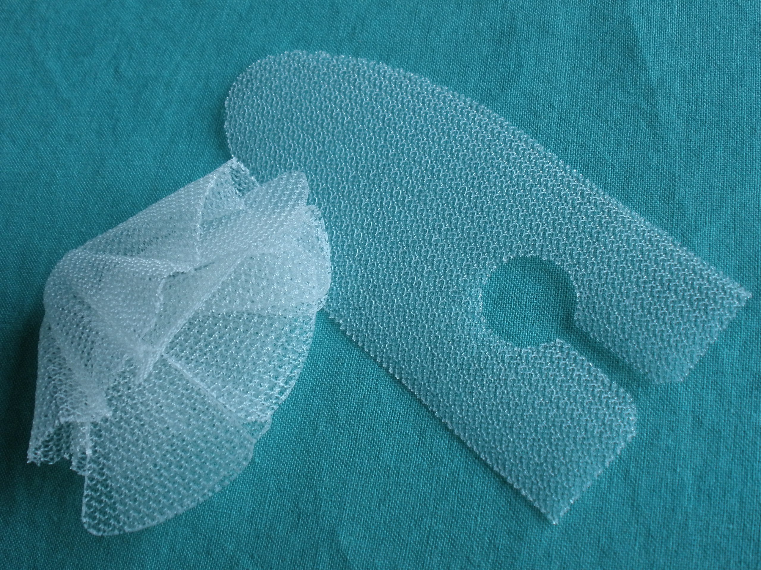 Использование сетки в операциях на брюшную полость: от грыжи до восстановления