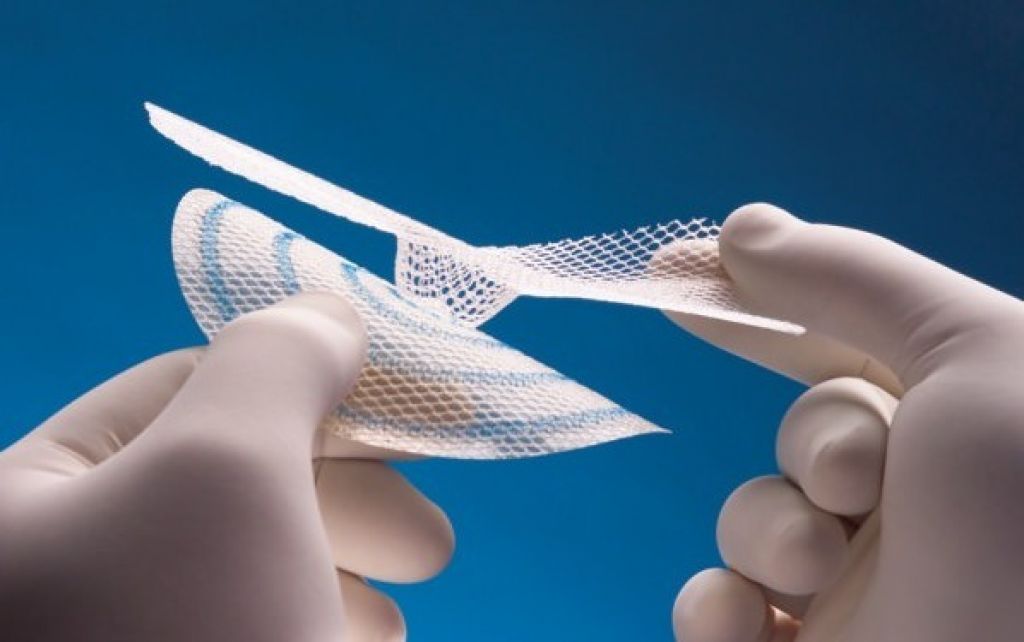 Герниопластика пупочной грыжи сеткой: как выбрать и купить сетку для операции